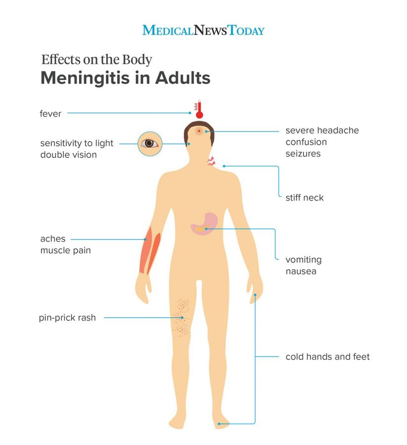 Meningitis side effects in adults. Photo retrieved from Medical News Today. 