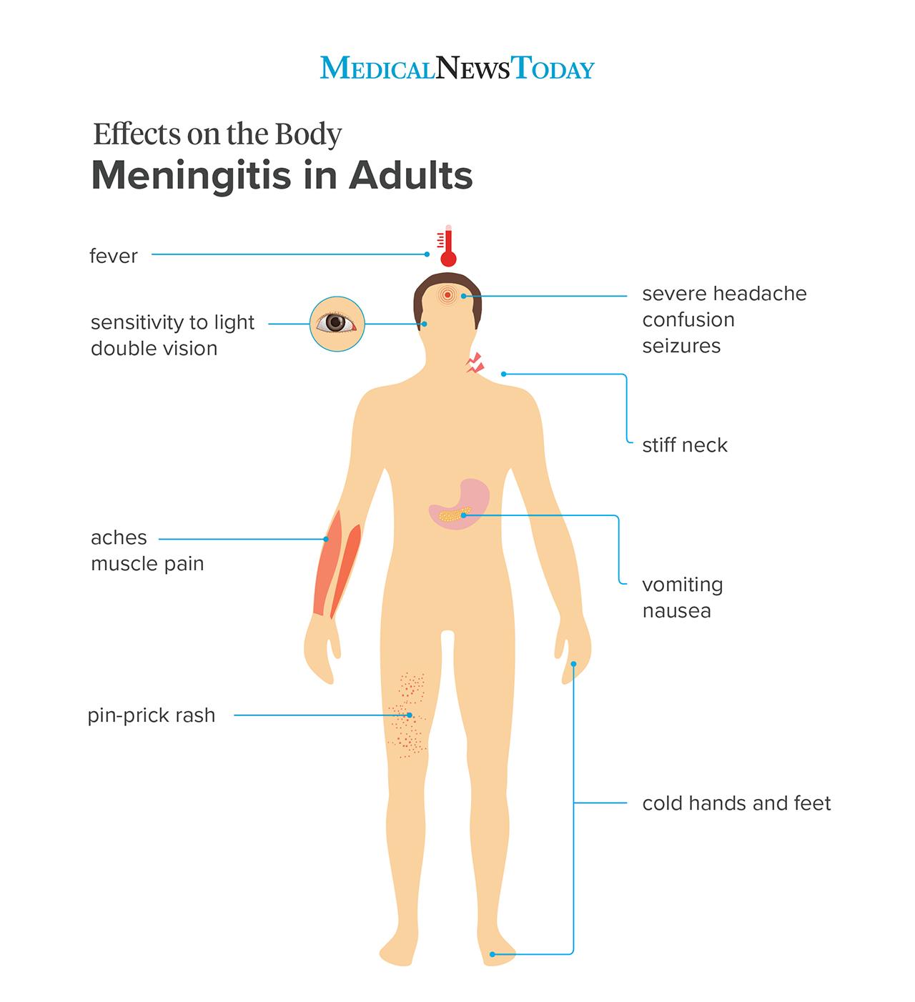 Everything About Meningitis And Neck Pain